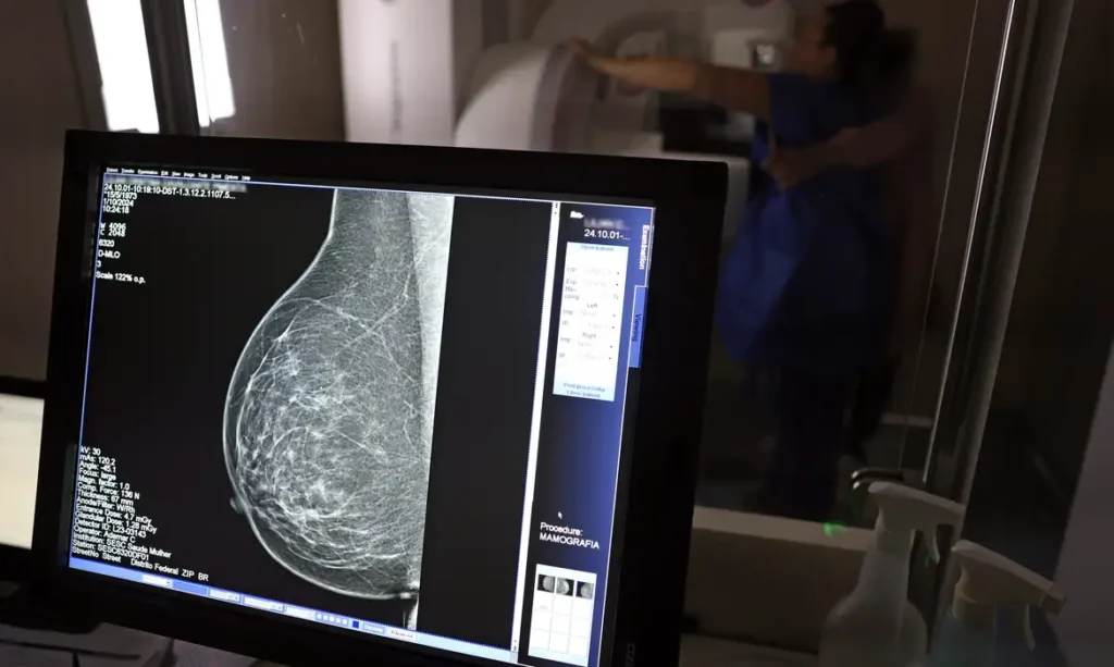 Entidades médicas alertam sobre riscos de negação em pedidos de mamografia digital