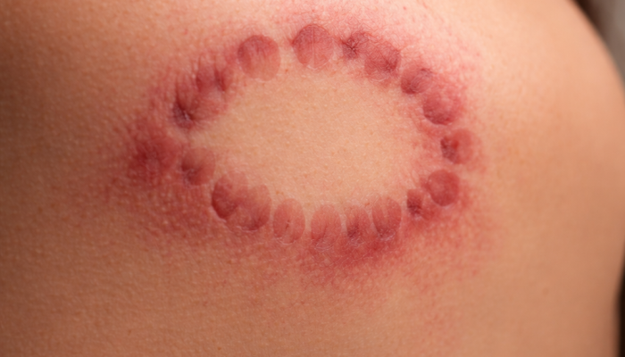 39933C4B-0F38-4E4B-9978-4F33682FCE8E