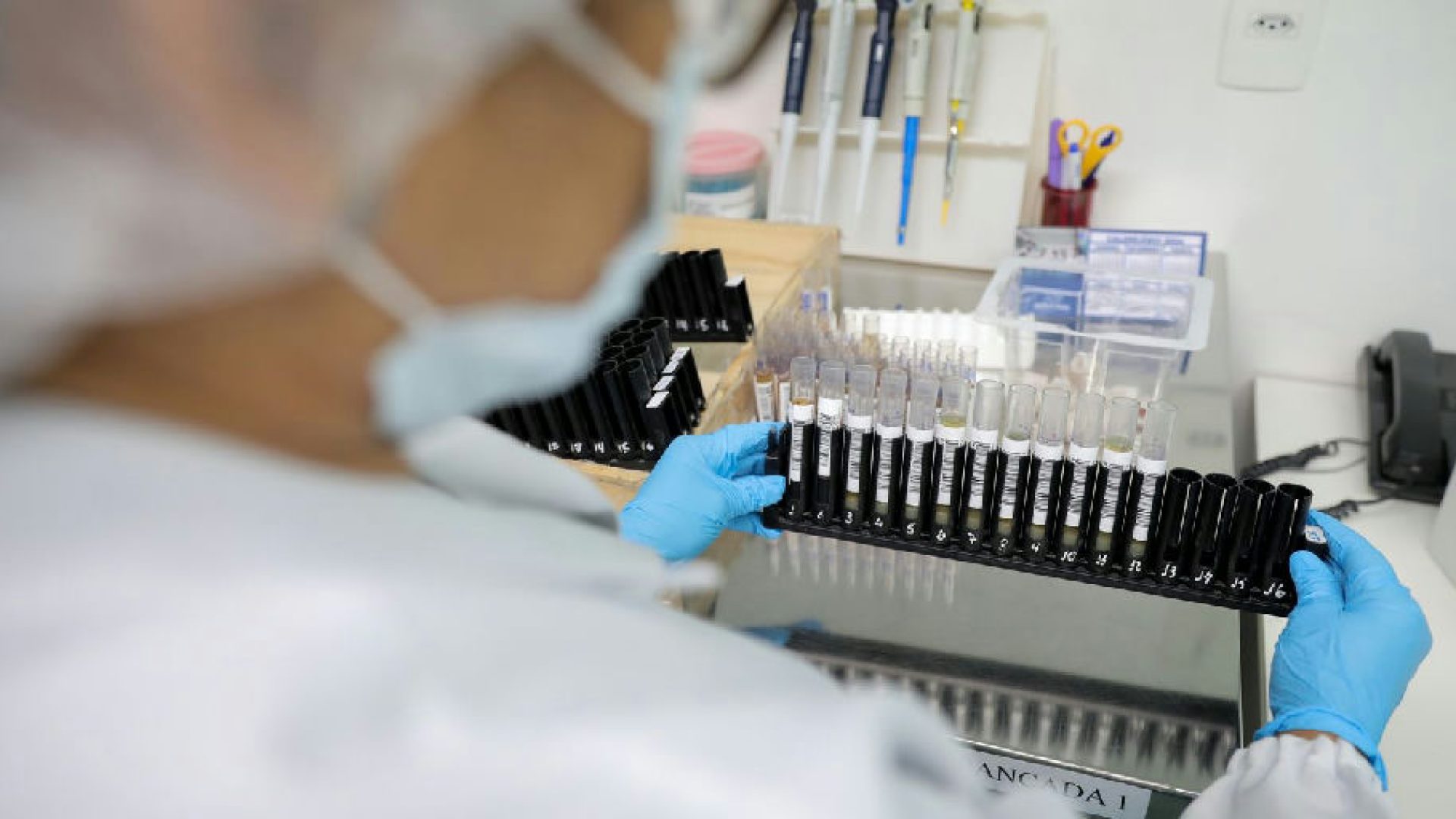Anvisa libera testes da vacina brasileira contra malária com aporte de R$ 12 milhões