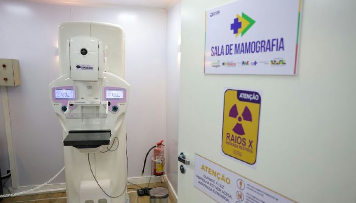 Câncer de mama em homens: diagnóstico tardio eleva riscos de metástase
