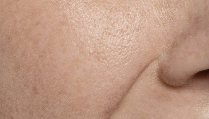 close-up-face-pores-texture