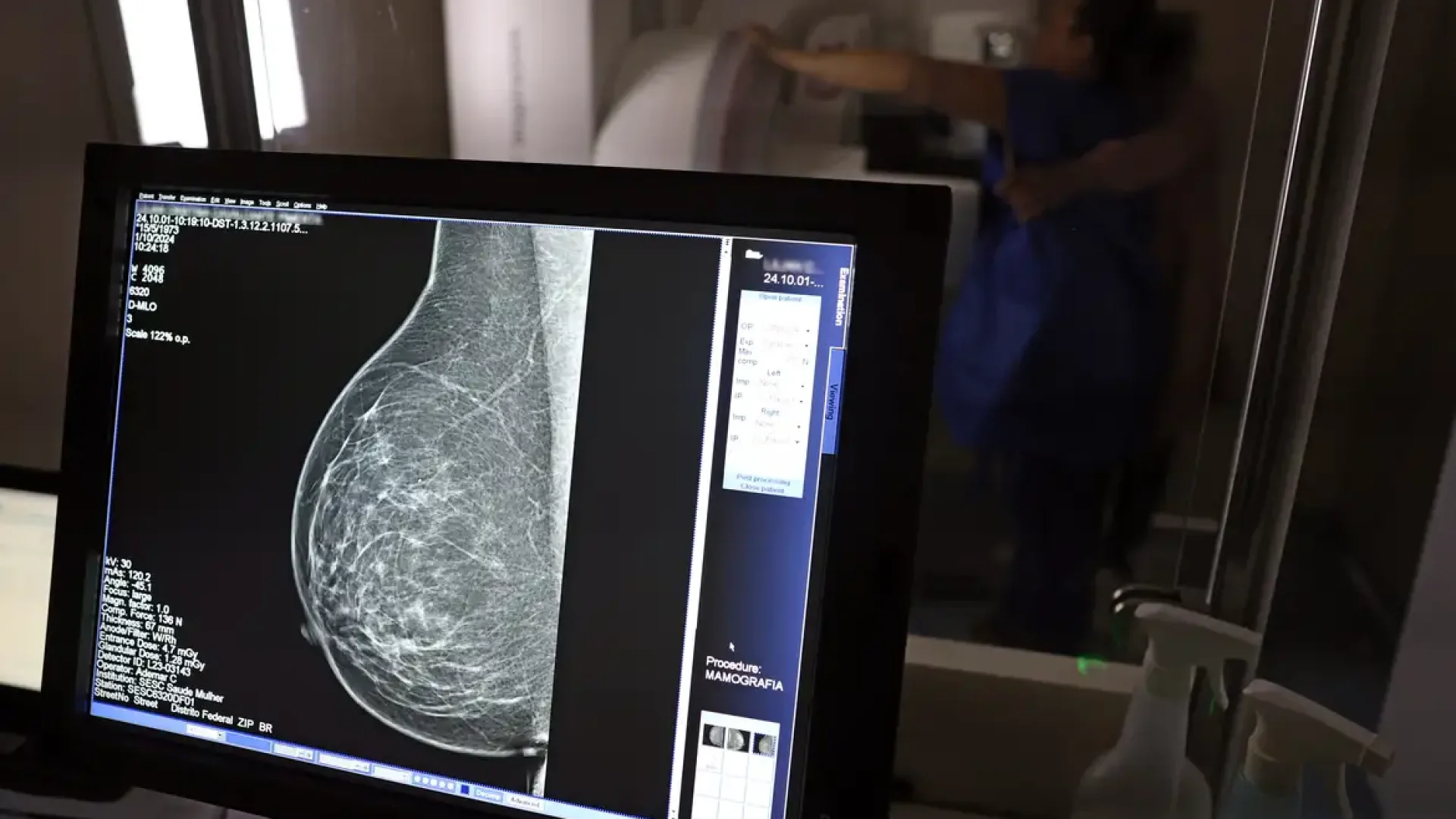 Entidades médicas alertam sobre riscos de negação em pedidos de mamografia digital