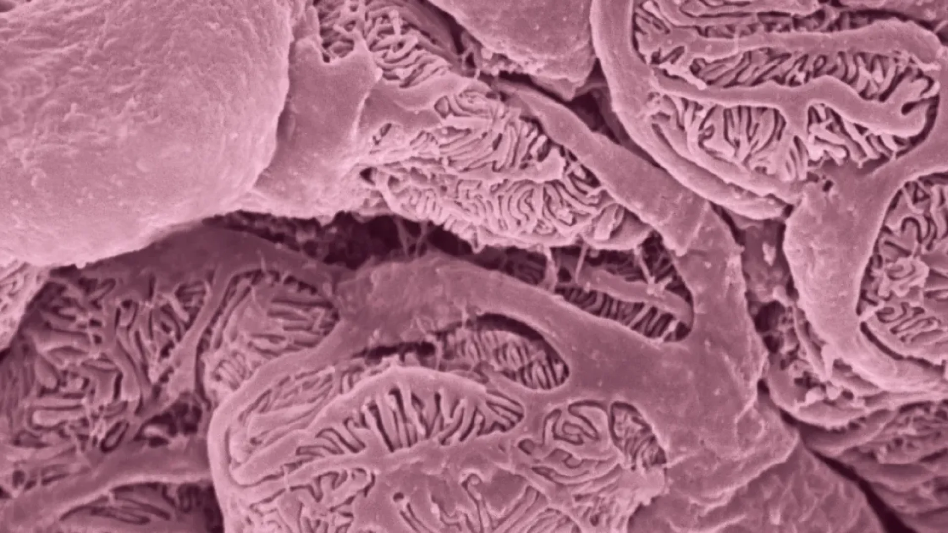 Glomérulo renal: a estrutura microscópica que protege a sua saúde