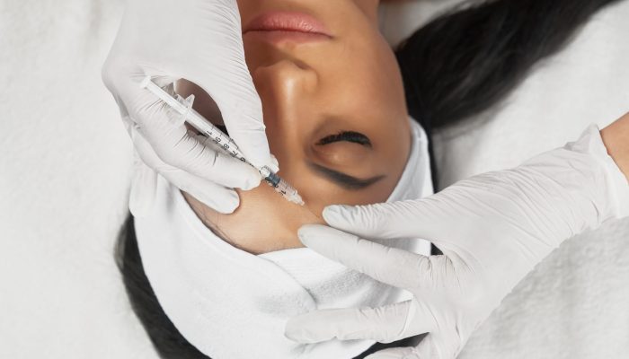 From above view of hyaluronic injection in female forehead. Cosmetologist using syringe with filler while brunette patient with closed eyes, in towel on head lying. Concept of cosmetology, beauty.