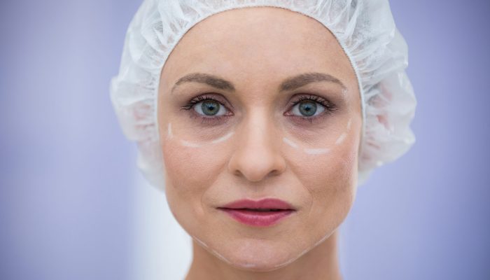 Portrait of woman with marks for cosmetic treatment wearing surgical cap