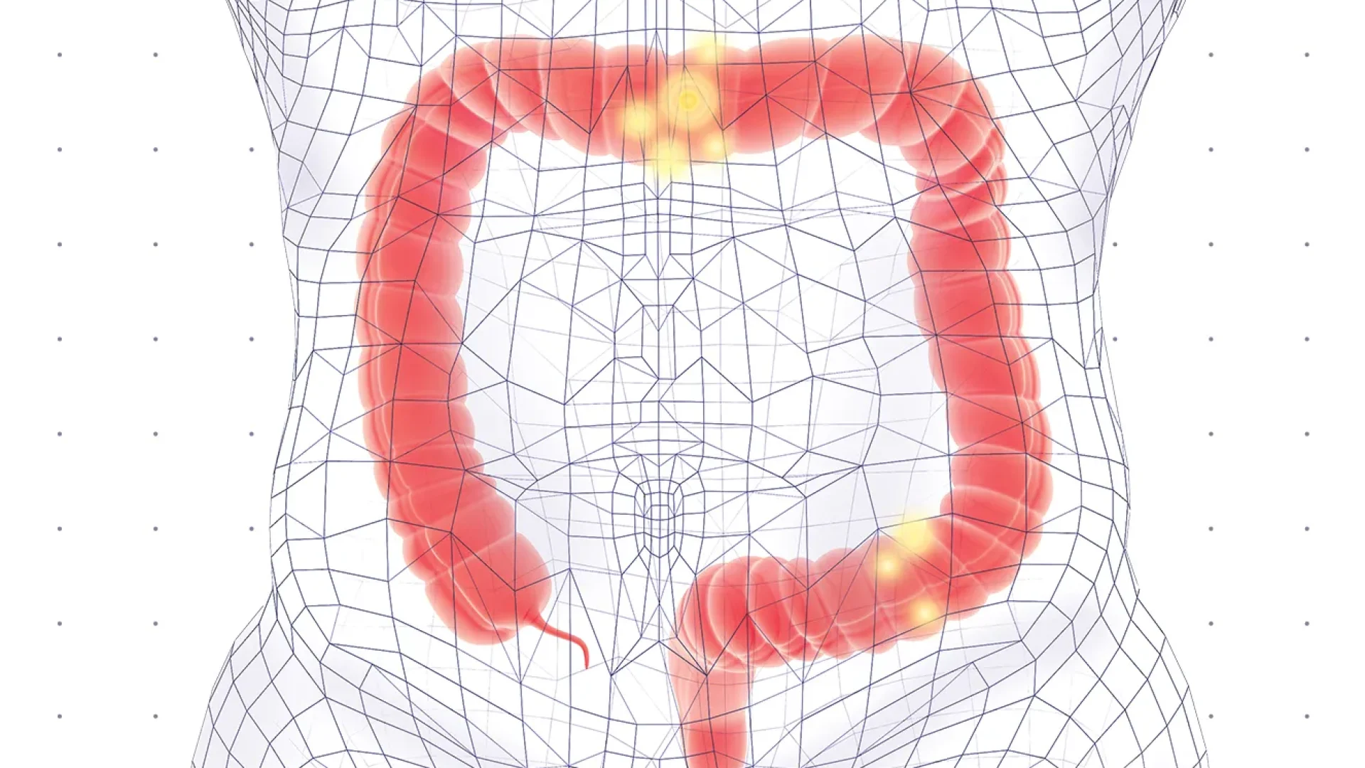 Novos estudos revelam avanços promissores da imunoterapia contra o câncer colorretal