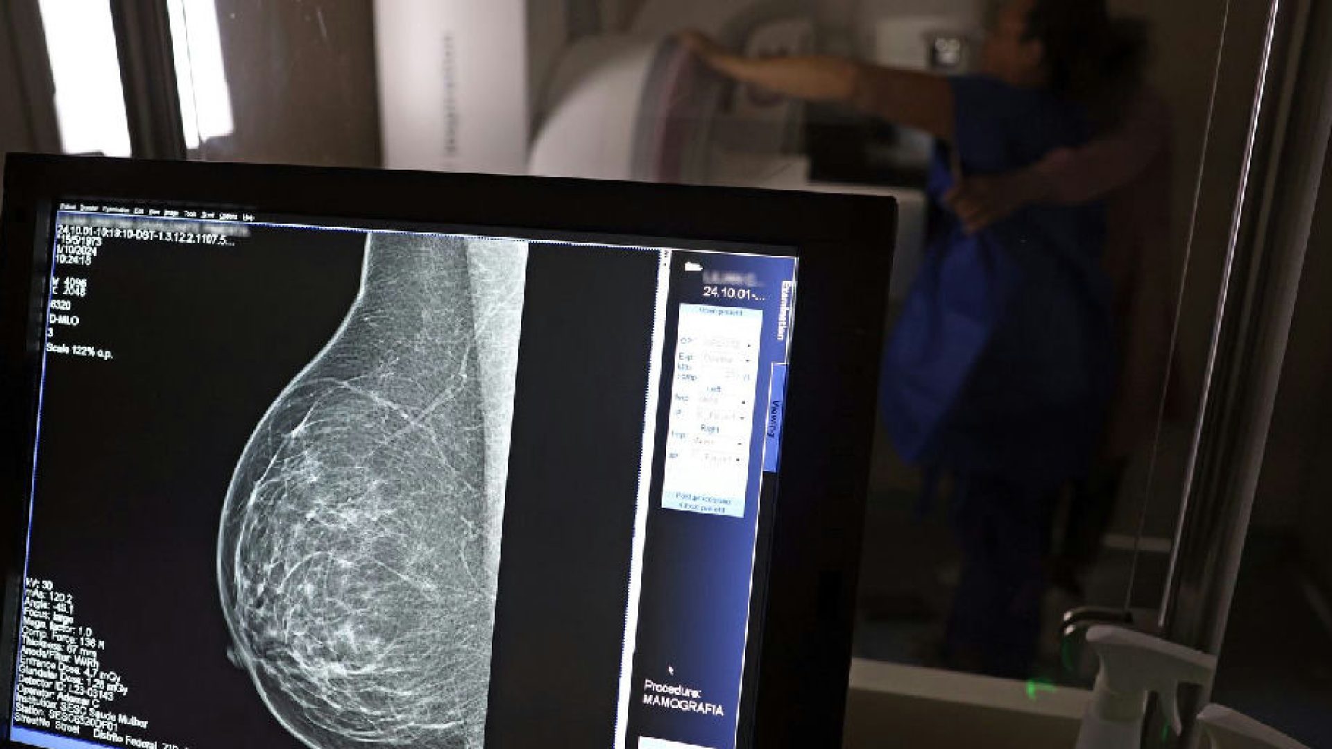 Planos de saúde passam a cobrir mamografia digital sem restrição de idade