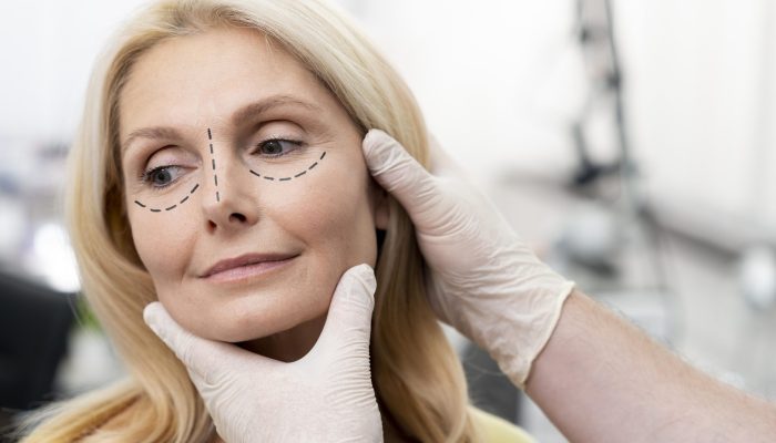 woman-getting-ready-nose-job-surgery