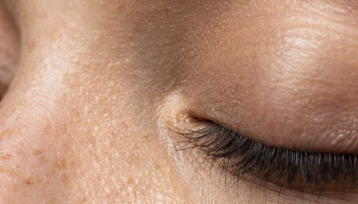 young-woman-skin-texture-side-view